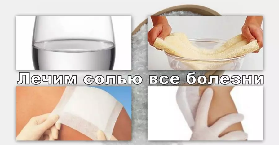 компрессы