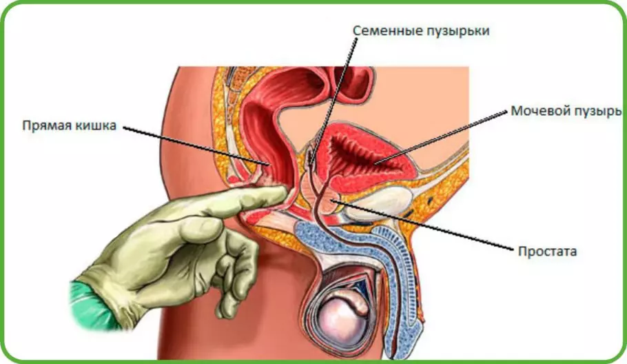Но во избежание воспаления лучше всего проводить профилактические массажи